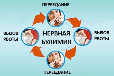 Лечение булимии в Приаргунске